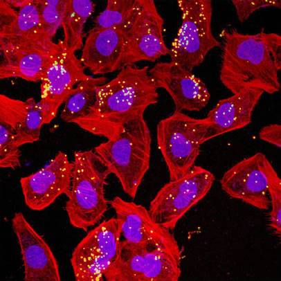 Meningitis bacteria