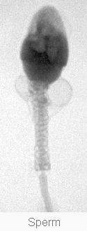 Sperm2