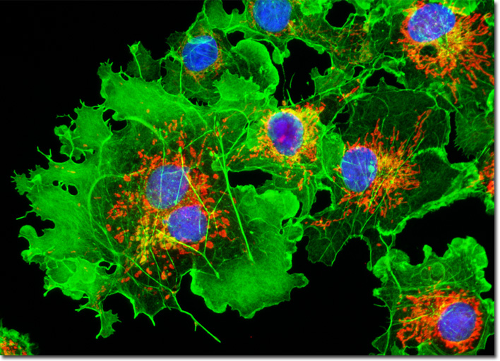 Diseased African Green Monkey Kidney Fibroblast Cells