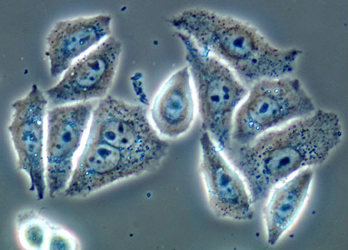 human diploid cells